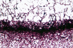 candida albicans yeast