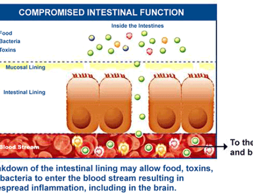 What Is Leaky Gut Syndrome?